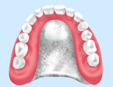 自費の入れ歯