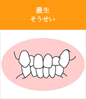 叢生そうせい