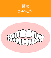 開咬かいこう