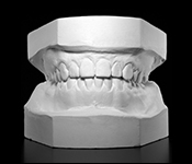 STEP1.歯型採取